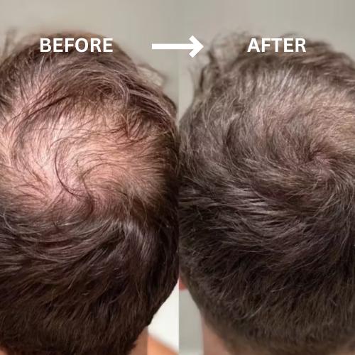 Hair Filloura ™ Pro-Keratin Complex