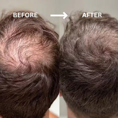 Hair Filloura ™ Pro-Keratin Complex