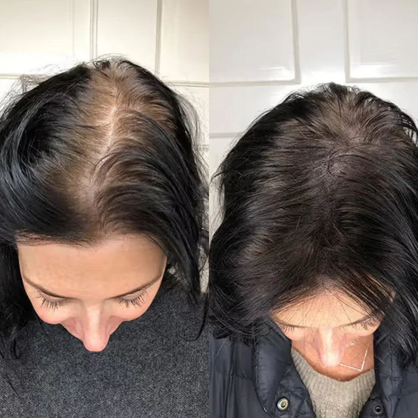 Hair Filloura ™ Pro-Keratin Complex